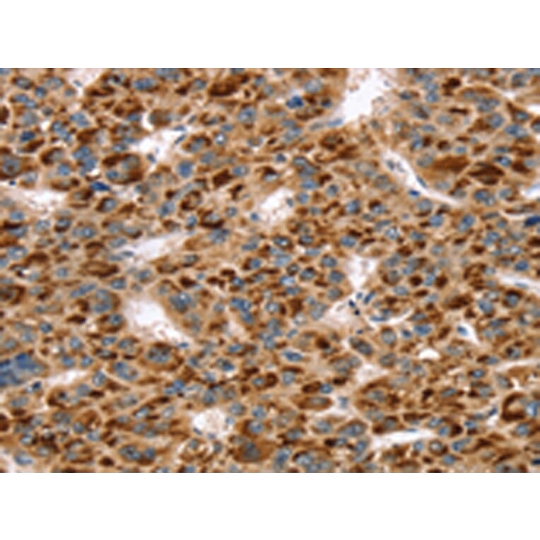 Immunohistochemistry - SKIL Antibody from Signalway Antibody (42764) - Antibodies.com