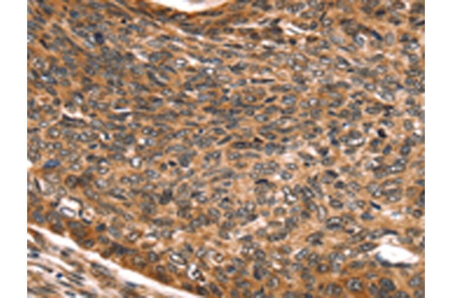 Immunohistochemistry - SKIL Antibody from Signalway Antibody (42764) - Antibodies.com