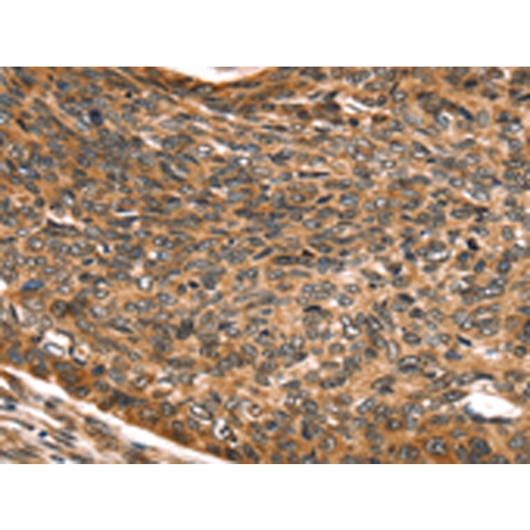 Immunohistochemistry - SKIL Antibody from Signalway Antibody (42764) - Antibodies.com