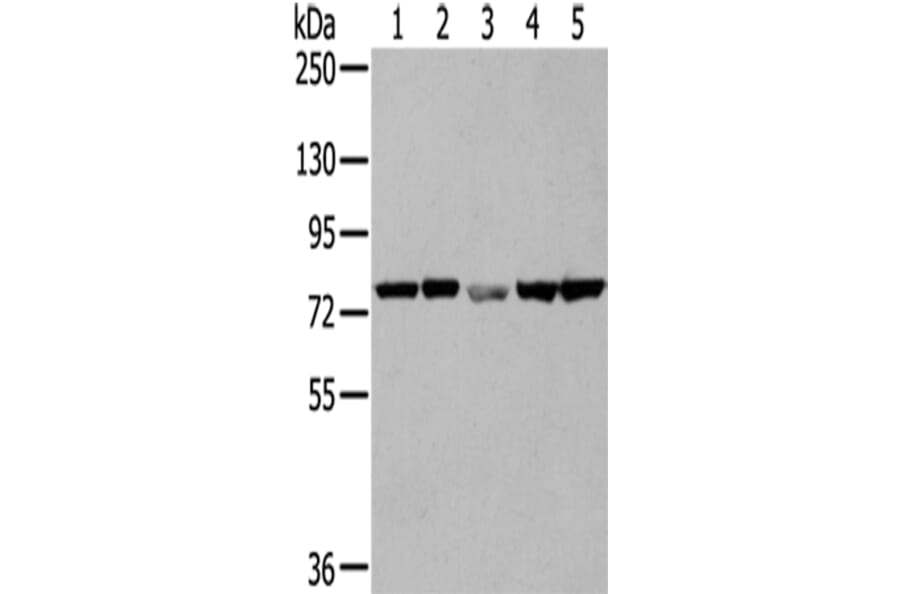 TGM5 Antibody from Signalway Antibody (42785) - Antibodies.com