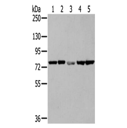 TGM5 Antibody from Signalway Antibody (42785) - Antibodies.com