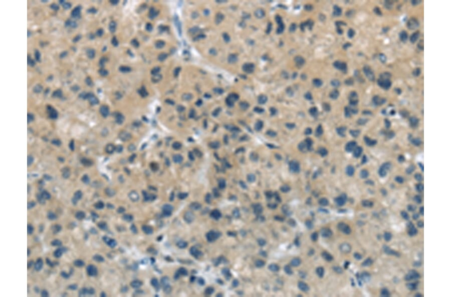 Immunohistochemistry - TGM5 Antibody from Signalway Antibody (42785) - Antibodies.com