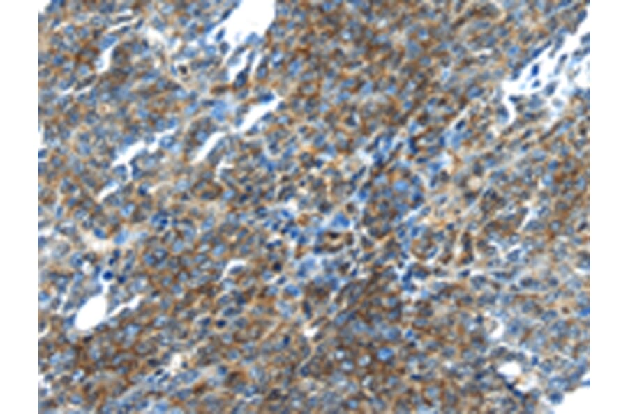 Immunohistochemistry - TGM5 Antibody from Signalway Antibody (42785) - Antibodies.com