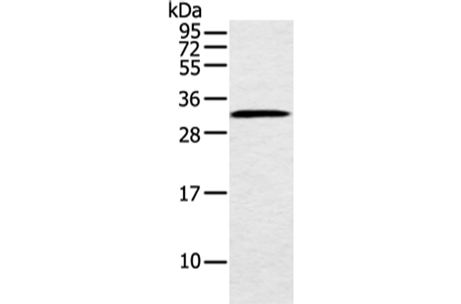 MED6 Antibody from Signalway Antibody (42787) - Antibodies.com