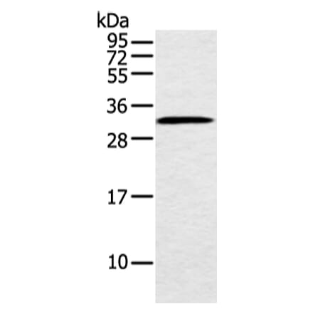 MED6 Antibody from Signalway Antibody (42787) - Antibodies.com