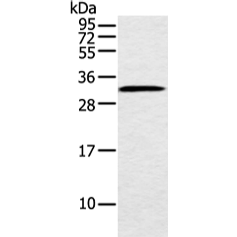 MED6 Antibody from Signalway Antibody (42787) - Antibodies.com