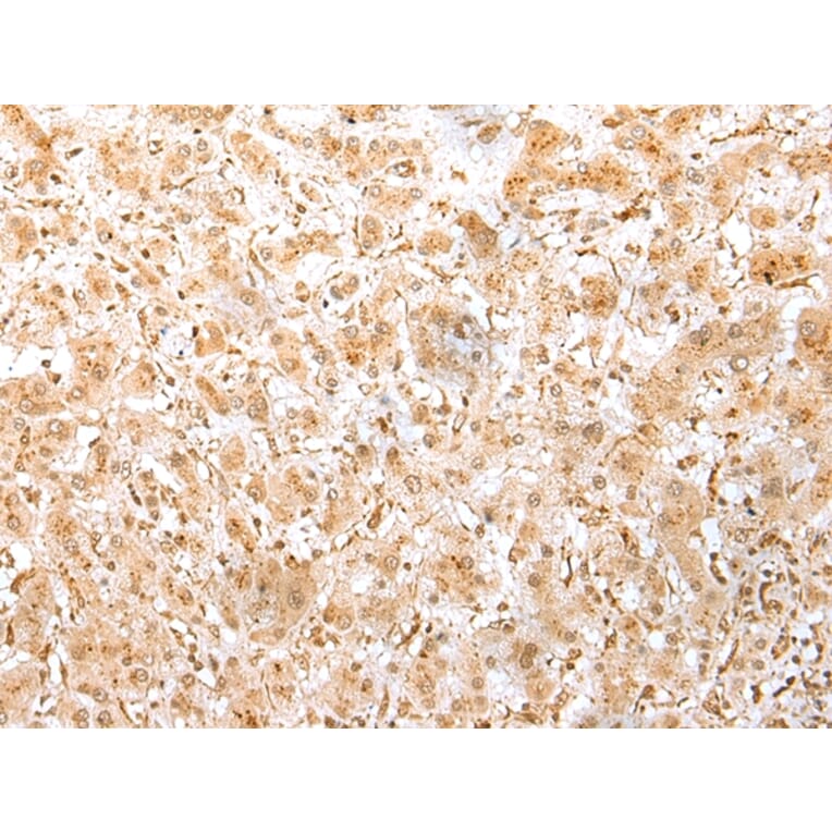 Immunohistochemistry - MED6 Antibody from Signalway Antibody (42787) - Antibodies.com