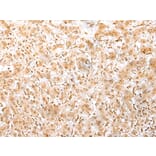 Immunohistochemistry - MED6 Antibody from Signalway Antibody (42787) - Antibodies.com