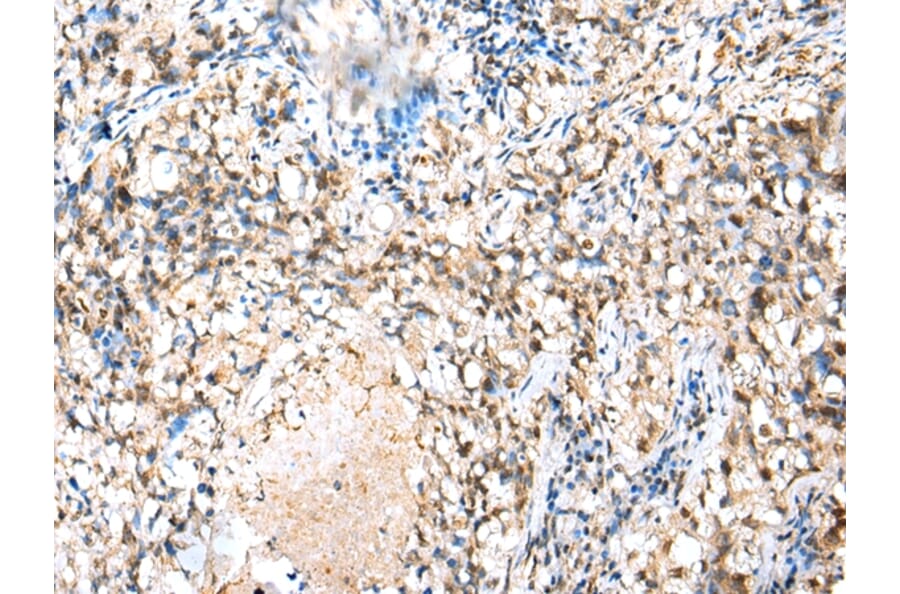 Immunohistochemistry - MED6 Antibody from Signalway Antibody (42787) - Antibodies.com