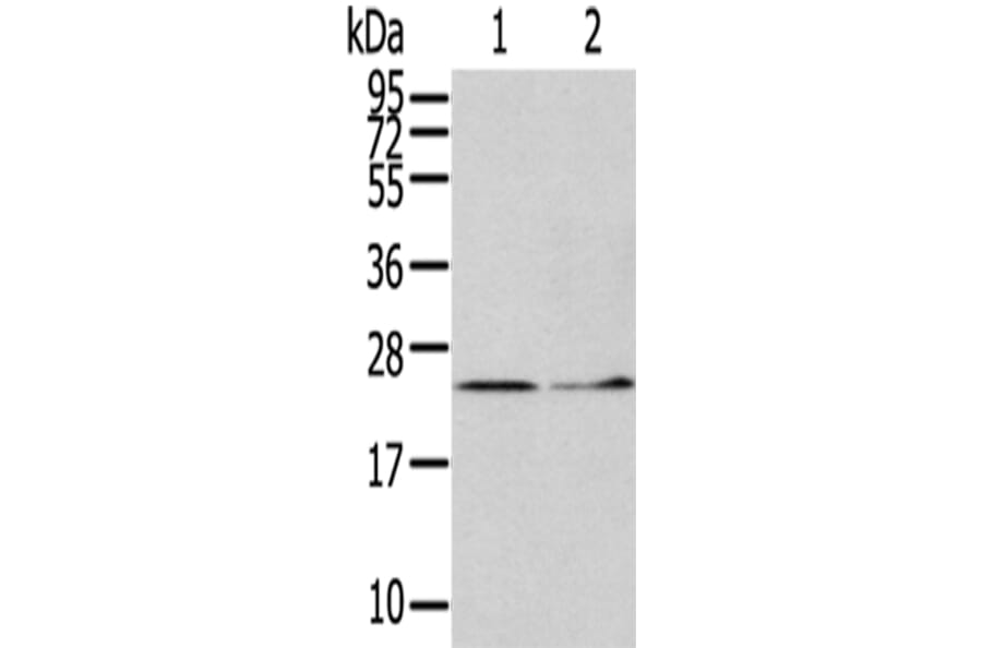 ITPA Antibody from Signalway Antibody (42788) - Antibodies.com