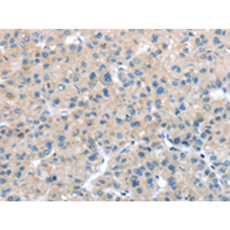Immunohistochemistry - ITPA Antibody from Signalway Antibody (42788) - Antibodies.com