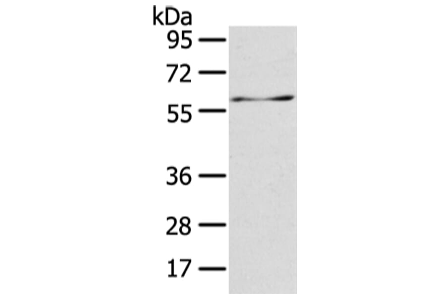 ATIC Antibody from Signalway Antibody (42810) - Antibodies.com