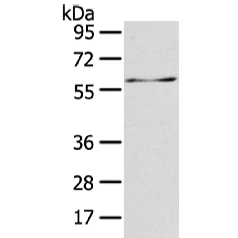 ATIC Antibody from Signalway Antibody (42810) - Antibodies.com