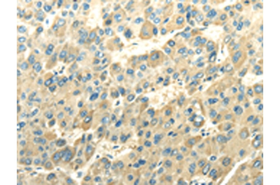Immunohistochemistry - DLAT Antibody from Signalway Antibody (42811) - Antibodies.com