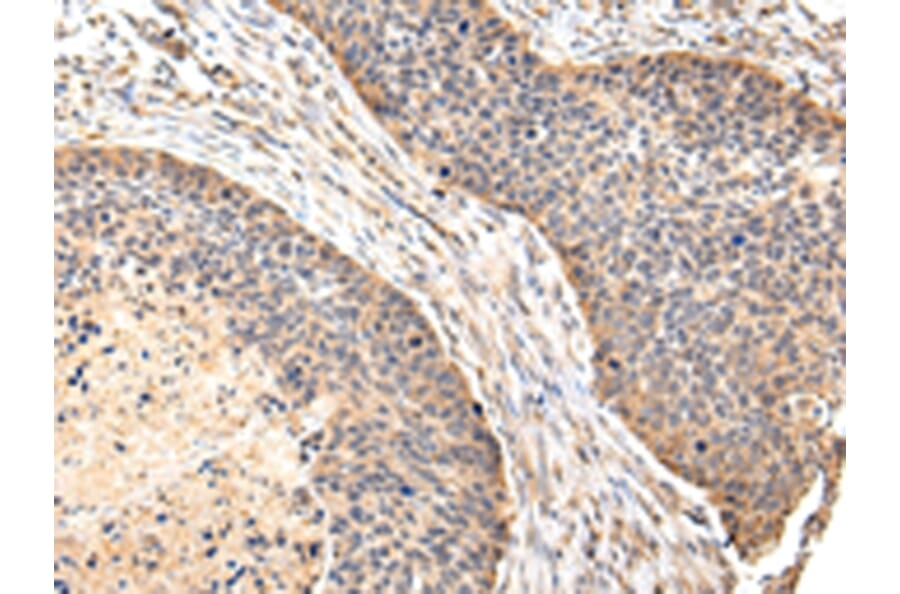 Immunohistochemistry - VIL1 Antibody from Signalway Antibody (42831) - Antibodies.com