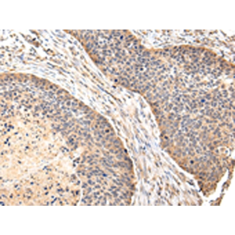 Immunohistochemistry - VIL1 Antibody from Signalway Antibody (42831) - Antibodies.com