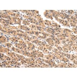 Immunohistochemistry - VIL1 Antibody from Signalway Antibody (42831) - Antibodies.com