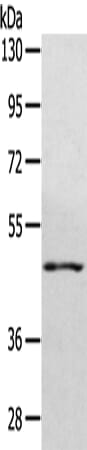 Gel: 8% SDS-PAGE Lysate: 40 &#956;g Lane: NIH/3T3 cell Primary antibody: 1/450 dilution Secondary antibody: Goat anti rabbit IgG at 1/8000 dilution Exposure time: 30 seconds