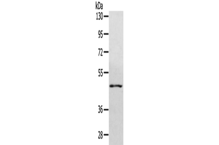 WDR4 Antibody from Signalway Antibody (42846) - Antibodies.com
