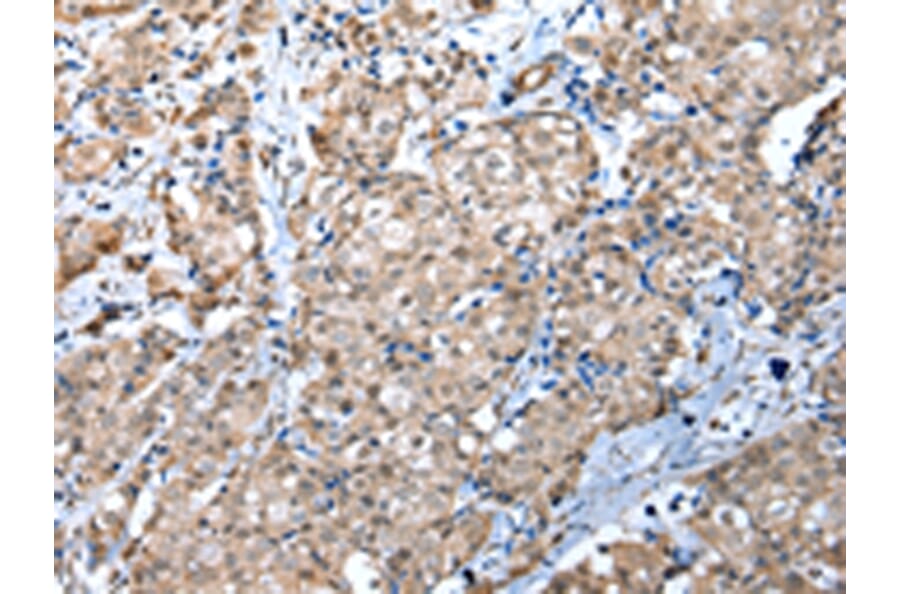 Immunohistochemistry - WDR4 Antibody from Signalway Antibody (42846) - Antibodies.com