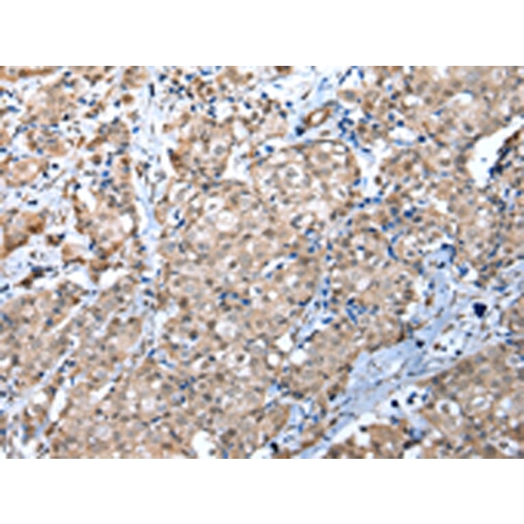 Immunohistochemistry - WDR4 Antibody from Signalway Antibody (42846) - Antibodies.com