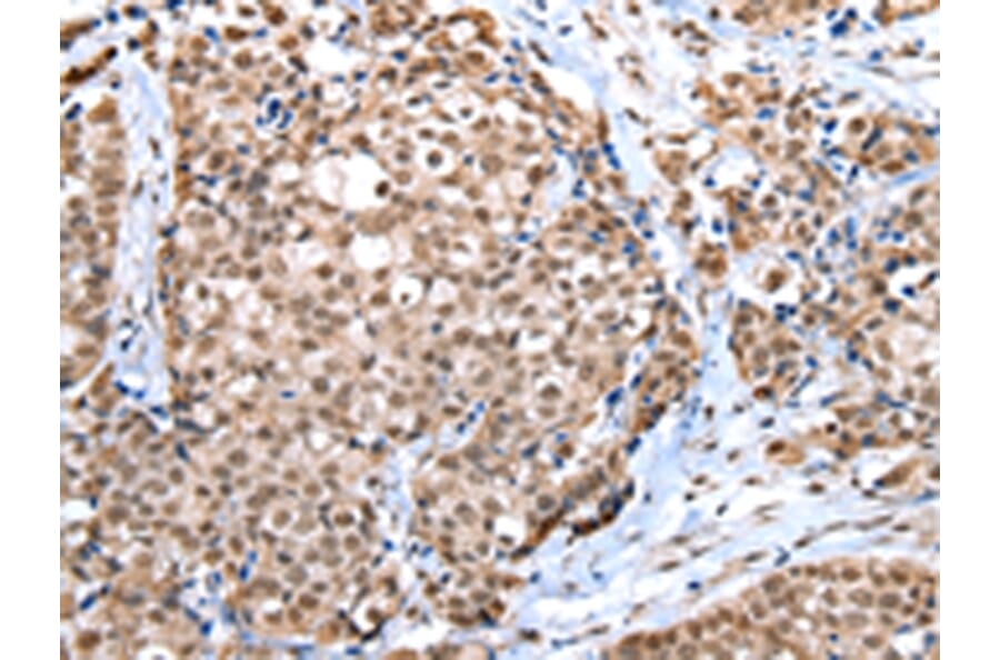 Immunohistochemistry - WDR5 Antibody from Signalway Antibody (42847) - Antibodies.com