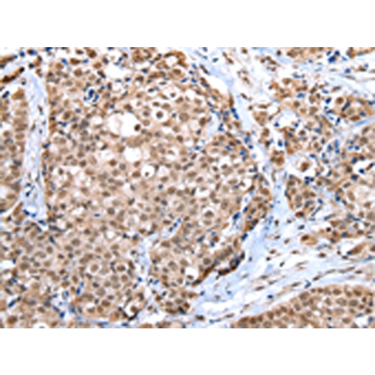 Immunohistochemistry - WDR5 Antibody from Signalway Antibody (42847) - Antibodies.com