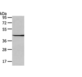 WIF1 Antibody from Signalway Antibody (42858) - Antibodies.com