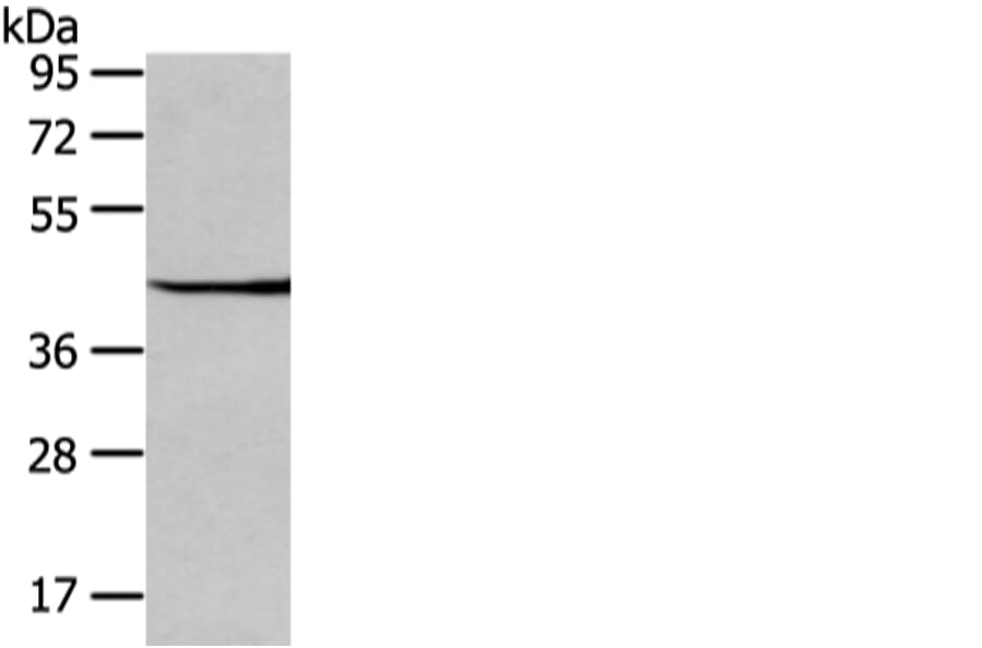 WIF1 Antibody from Signalway Antibody (42858) - Antibodies.com