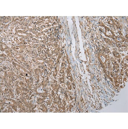 Immunohistochemistry - TBCA Antibody from Signalway Antibody (42897) - Antibodies.com