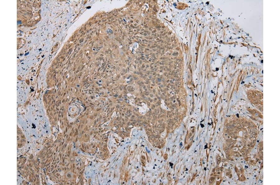 Immunohistochemistry - TBCA Antibody from Signalway Antibody (42897) - Antibodies.com