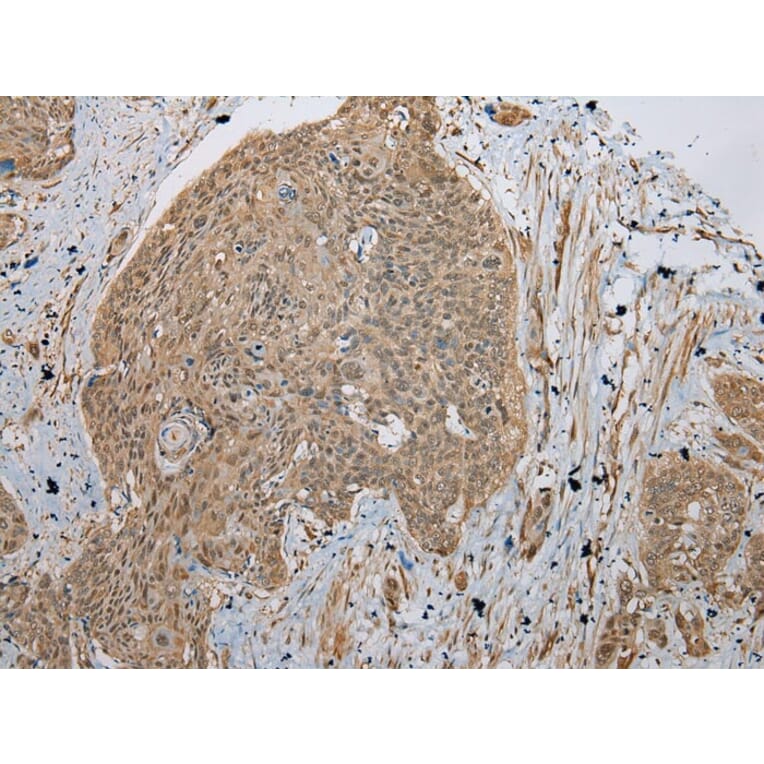 Immunohistochemistry - TBCA Antibody from Signalway Antibody (42897) - Antibodies.com