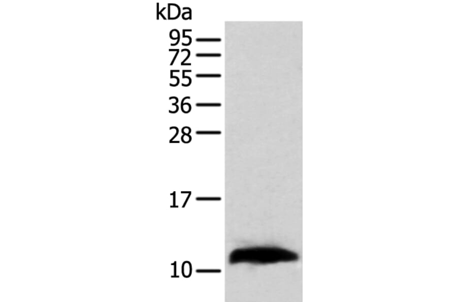 TBCA Antibody from Signalway Antibody (42897) - Antibodies.com
