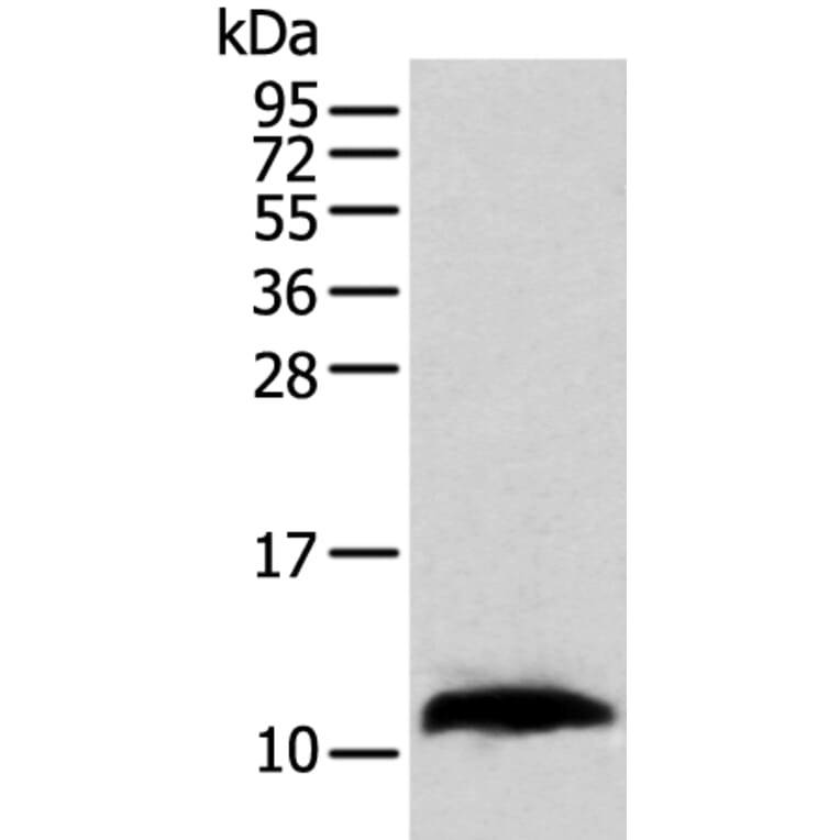 TBCA Antibody from Signalway Antibody (42897) - Antibodies.com