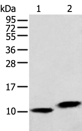 Gel: 12% SDS-PAGE Lysate: 40 &#956;g Lane 1-2: Hela cell and Human fetal liver tissue Primary antibody: 1/250 dilution Secondary antibody: Goat anti rabbit IgG at 1/8000 dilution Exposure time: 10 seconds