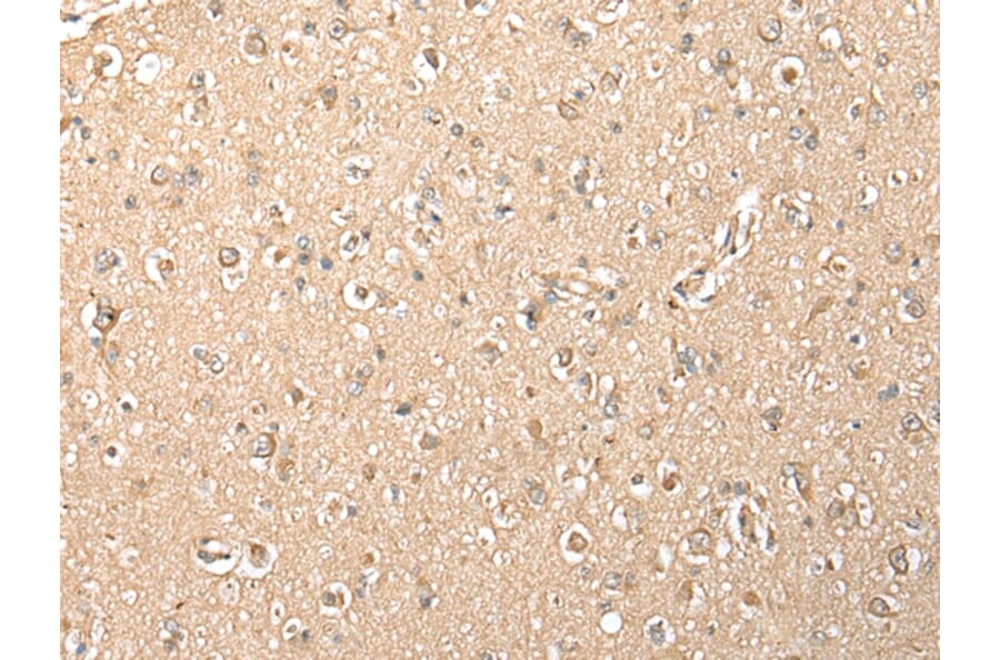 Immunohistochemistry - MPC1 Antibody from Signalway Antibody (42898) - Antibodies.com