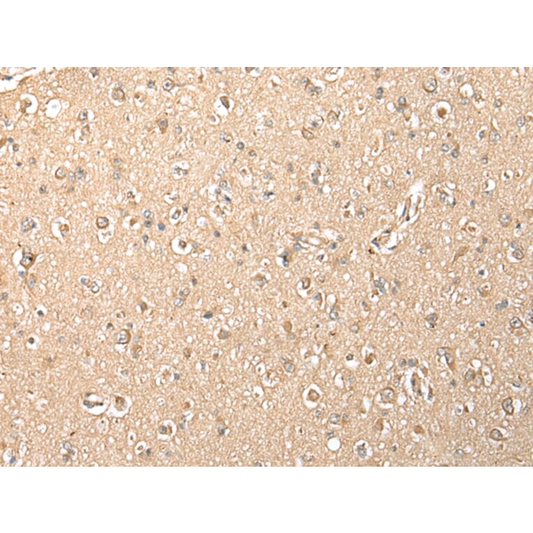 Immunohistochemistry - MPC1 Antibody from Signalway Antibody (42898) - Antibodies.com