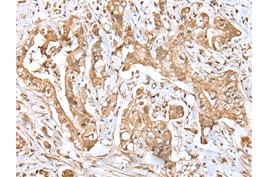 Immunohistochemistry - MPC1 Antibody from Signalway Antibody (42898) - Antibodies.com