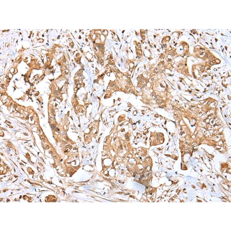 Immunohistochemistry - MPC1 Antibody from Signalway Antibody (42898) - Antibodies.com