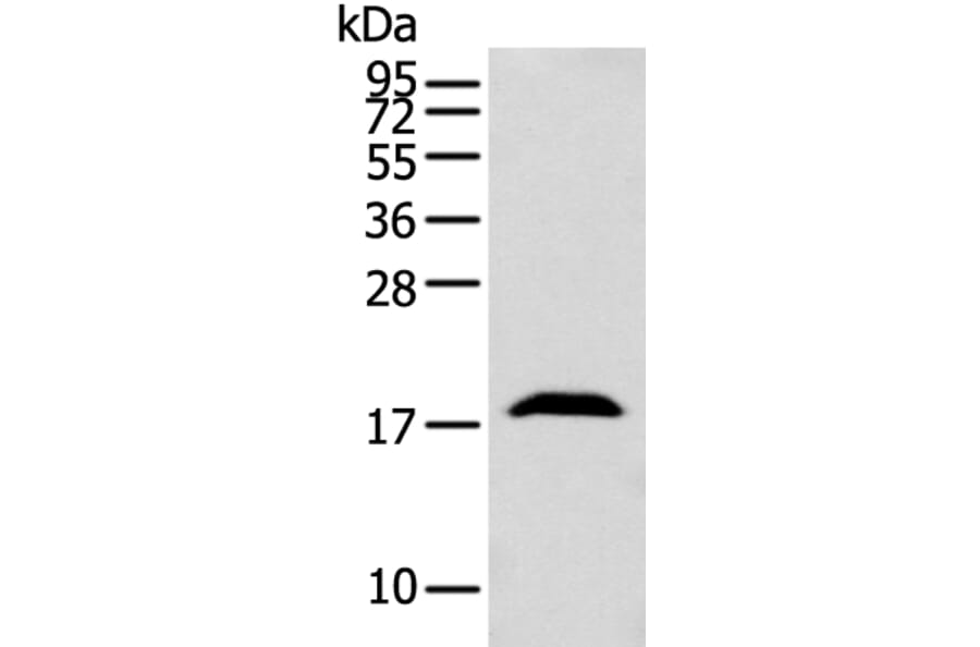 GMFB Antibody from Signalway Antibody (42956) - Antibodies.com