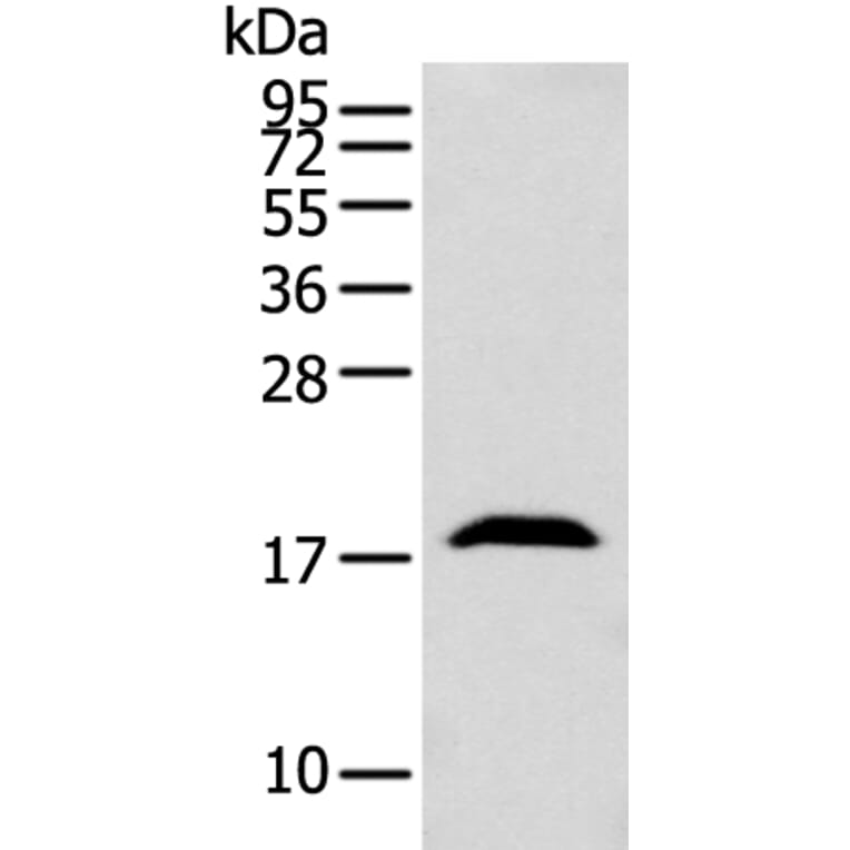 GMFB Antibody from Signalway Antibody (42956) - Antibodies.com