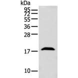 GMFB Antibody from Signalway Antibody (42956) - Antibodies.com