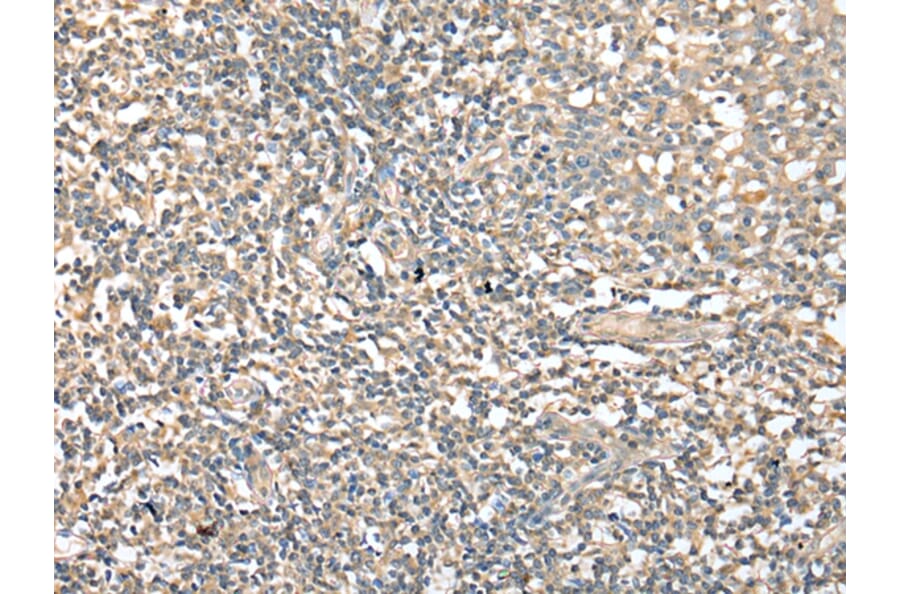 Immunohistochemistry - CD1D Antibody from Signalway Antibody (42961) - Antibodies.com