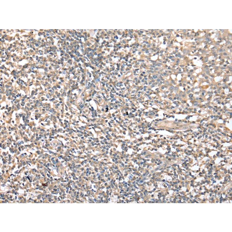 Immunohistochemistry - CD1D Antibody from Signalway Antibody (42961) - Antibodies.com