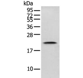 GM2A Antibody from Signalway Antibody (42969) - Antibodies.com