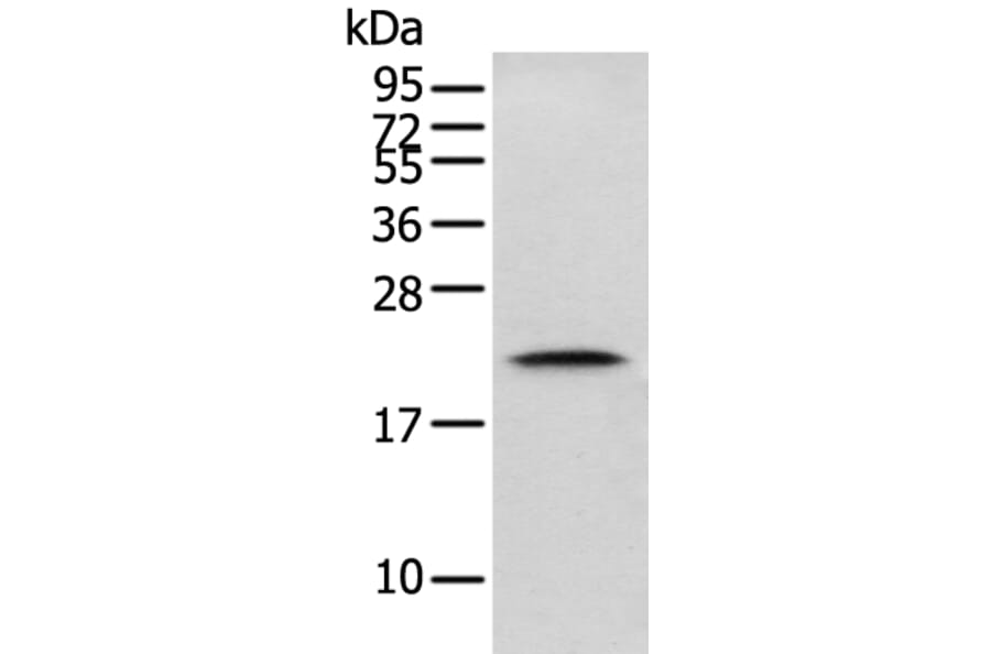 GM2A Antibody from Signalway Antibody (42969) - Antibodies.com