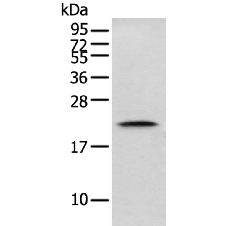 GM2A Antibody from Signalway Antibody (42969) - Antibodies.com