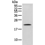 GM2A Antibody from Signalway Antibody (42969) - Antibodies.com