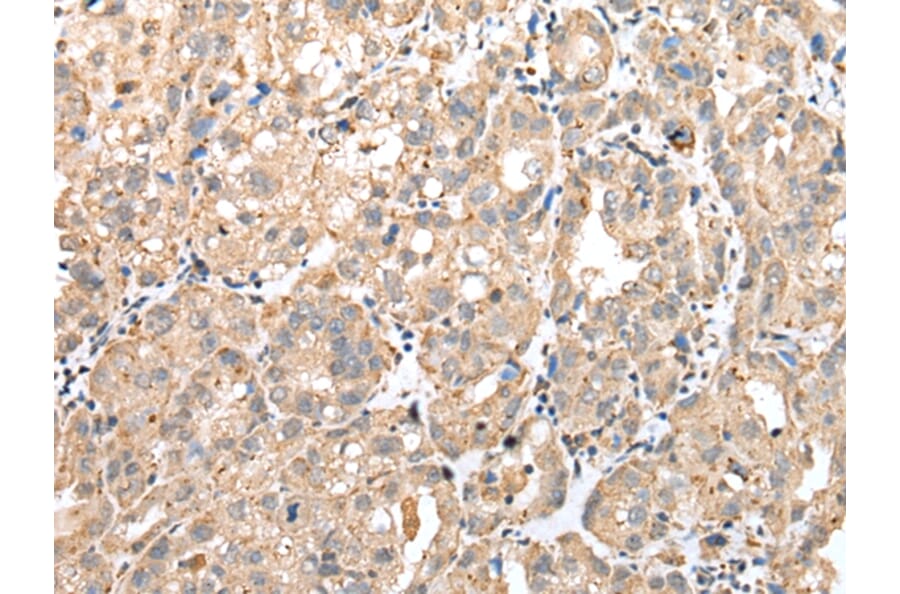 Immunohistochemistry - GM2A Antibody from Signalway Antibody (42969) - Antibodies.com