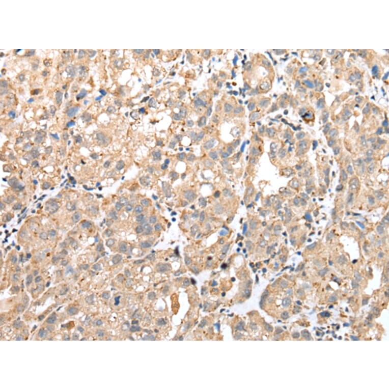 Immunohistochemistry - GM2A Antibody from Signalway Antibody (42969) - Antibodies.com